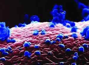 禽流感病毒图片